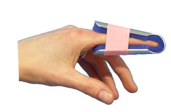 STECCA PER FRATTURA DITA A CAMPANA FARMASPLINT MISURA GRANDE PREFORMATA IN ALLUMINIO MODELLABILE CON IMBOTTITURA IN SPUGNA POLIURETANICA ANTIALLERGICA RADIOTRASPARENTE 15 CM - farmacialombardia.it