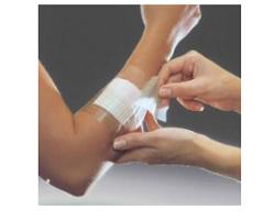 FILM ADESIVO IN POLIURETANO OPSITE FLEXIFIX IN ROTOLO TRASPARENTE IMPERMEABILE PER FISSAGGIO DI MEDICAZIONI E CATETERI LARGHEZZA 15 CM LUNGHEZZA 10 M 1 PEZZO - farmacialombardia.it